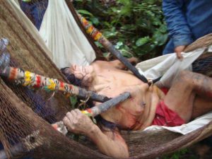 Buganey is in agony while being carried in a hammock to a doctor (source: http://polificcion.wordpress.com/)